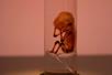 A fetal model in a glass tube on display at REAL BODIES at Horseshoe Las Vegas.