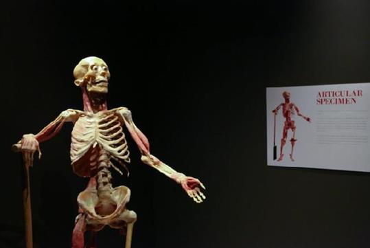 The initial complete body specimen that allows you to explore human anatomy on display at REAL BODIES at Horseshoe Las Vegas.