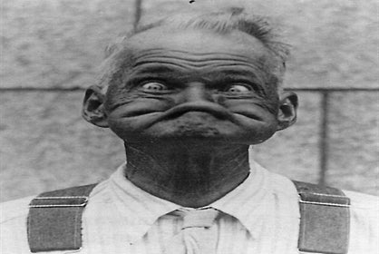 Close up of an old photo of a man making a funny face on display at Ripley's Believe It or Not! Orlando Odditorium.
